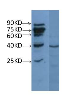 western blot using anti-NAD(P)H-quinone oxidoreductase subunit H, chloroplastic antibodies